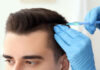 مزوتراپی Mesotherapy